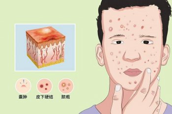 �Ͼ�Ƥ�������ô��